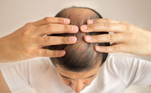 植发导致死亡的原因 种植毛发的危险 种植毛发有哪些副作用
